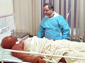 در مواجهه با فرد دچار سوختگی چه کنیم؟