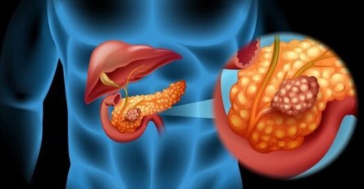 علایم هشداردهنده یک بیماری خاموش